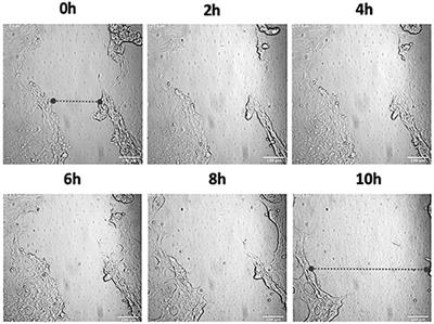 Group A Streptococcus-Induced Activation of Human Plasminogen Is Required for Keratinocyte Wound Retraction and Rapid Clot Dissolution